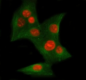 Immunofluorescent staining of FFPE human U-2 OS cells with Ku70 antibody (red) and Beta Tubulin mAb (green). HIER: steam section in pH6 citrate buffer for 20 min.