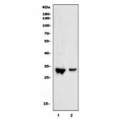 Western blot testing of human 1) Jurkat and 2) HepG2 cell lysate with Cdk2 antibody. Predicted molecular weight ~33 kDa.