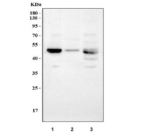 Western blot testing of rat 1) lung, 2) kidney, 3) thymus, and 4) mouse kidney lysate with LOX antibody. Expected molecular weight: ~47 kDa (unprocessed/unmodified), ~50 kDa (glycosylated), ~32 kDa (processed form).