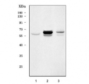 Western blot testing of 1) human HepG2, 2) rat liver and 3) mouse liver tissue lysate with PKLR antibody. Predicted molecular weight ~62 kDa.