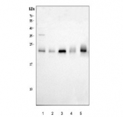 Western blot testing of 1) human K562, 2) human HepG2, 3) human 293T, 4) monkey COS-7 and 5) mouse NIH 3T3 cell lysate with RAB9 antibody. Expected molecular weight: ~23 kDa.