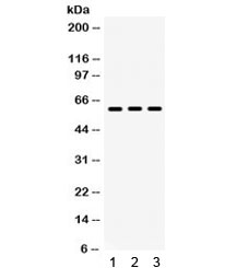 Western blot testing of mouse 1) testis, 2) thymus and 3) NIH3T3 lysate with Lumican antibody. Expected/observed moleculer weight: ~40/60 kDa (unmodified/glycosylated). (Ref 1)~