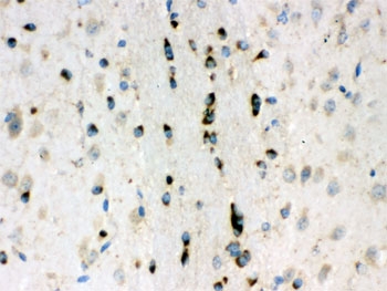IHC testing of FFPE mouse brain with Lumican antibody. HIER: Boil the