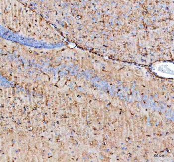 IHC testing of FFPE mouse brain with AQP4 antibody. HIER: Boil the paraffin sections in pH 8 EDTA buffer for 20 minutes and allow to cool prior to staining.