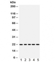 Western blot testing of 1) rat pancreas, 2) mouse intestine, 3) human HeLa, 4) COLO320, 5) SGC lysate with RAC1 antibody. Expected molecular weight ~22 kDa.