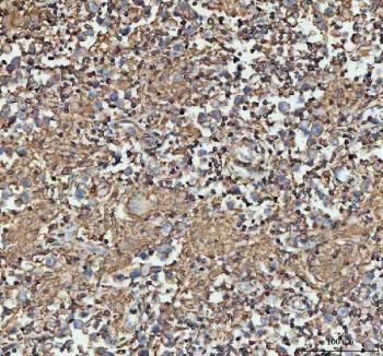 IHC testing of FFPE mouse spleen with Actin antibody. HIER: Boil the paraffin sections in pH 6, 10mM citrate buffer for 20 minutes and allow to cool prior to staining.