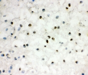 IHC staining of frozen mouse intestinal tissue with EWSR1 antibody at 1ug/ml.