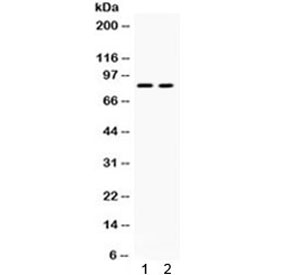 Western blot testing of human 1) HeLa and 2) HepG2 cell lysate with ZP2 antibody. Expected/observed molecular weight ~82 kDa.