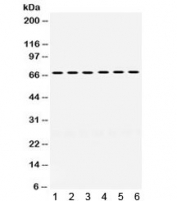 Western blot testing of human 1) HeLa, 2) 22RV1, 3) HepG2, 4) SKOV, 5) A431 and 6) HT1080 cell lysate with ERV3 antibody. Expected/observed molecular weight ~68 kDa.