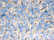 IHC testing of FFPE mouse brain with FCGRT antibody. HIER: Boil the paraffin sections in pH 6, 10mM citrate buffer for 20 minutes and allow to cool prior to staining.