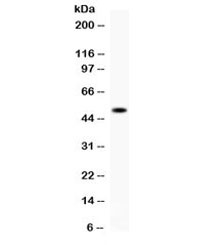 Western blot testing of mouse liver lysate with FCGRT antibody. Expected molecular weight ~51 kDa.~