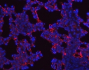 Immunofluorescent staining of FFPE rat lung tissue with SFTPA1/2 antibody (red) and DAPI nuclear stain (blue). HIER: steam section in pH6 citrate buffer for 20 min.