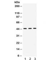 Western blot testing of 1) rat liver, 2) mouse liver and 3) human PANC lysate with ORM1 antibody. Expected molecular weight: 24/41-60 kDa (unmodified/glycosylated).