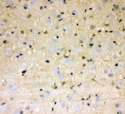 IHC staining of FFPE rat brain with DDAH1 antibody at 1ug/ml. HIER: boil tissue sections in pH6, 10mM citrate buffer, for 10-20 min followed by cooling at RT for 20 min.