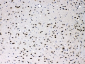 IHC testing of FFPE mouse brain with PSMA3 antibody at 1ug/ml. HIER: steam section in pH6 citrate buffer for 20 min.