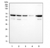 Western blot testing of 1) human SH-SY5Y, 2) human HepG2, 3) human HeLa, 4) human Jurkat and 5) rat testis tissue lysate with CYP17A1 antibody at 0.5ug/ml. Predicted molecular weight ~57 kDa.