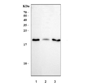 Western blot testing of human 1) 293T, 2) A549 and 3) K562 cell lysate with APRT antibody at 0.5ug/ml. Predicted molecular weight ~20 kDa.
