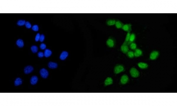 Immunofluorescent staining of FFPE human MCF7 cells with APRT antibody (green) and DAPI nuclear stain (blue). HIER: steam section in pH6 citrate buffer for 20 min.