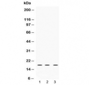 Western blot testing of 1) rat brain, 2) mouse NIH3T3 and 3) human HeLa lysate with LMO1 antibody at 0.5ug/ml. Predicted molecular weight ~18 kDa.