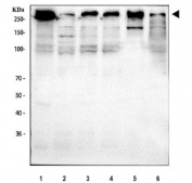 Western blot testing of 1) human HeLa, 2) human MCF7, 3) human T-47D, 4) human Caco-2, 5) rat C6 and 7) mouse Neuro-2a cell lysate with BRCA1 antibody. Predicted molecular weight ~207 kDa, commonly observed at 207-220 kDa.