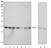 Western blot testing of 1) human A431, 2) human Jurkat, 3) human HepG2, 4) human PC-3, 5) human U-2 OS, 6) human A549, 7) human MCF7, 8) rat C6 and 9) mouse NIH 3T3 cell lysate with MED6 antibody. Predicted molecular weight ~28 kDa, commonly observed at 28-33 kDa.