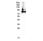 Western blot testing of human plasma lysate with Prothrombin antibody at 0.5ug/ml. Predicted molecular weight ~70 kDa, but may be observed at higher molecular weights due to glycosylation.
