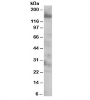 Western blot testing of 293 lysate with EIF4ENIF1 antibody at 0.25ug/ml. Expected molecular weight ~88/108 kDa (multiple isoforms but can be observed at ~140 kDa (possibly due to phosphorylation or high proline content-Ref 1).