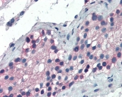 IHC testing of FFPE human testis with FOXE1 antibody at 5ug/ml. HIER: steamed with pH9 Tris/EDTA buffer, AP-staining.