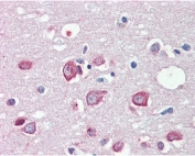 IHC testing of FFPE human brain (cortex) with MLL4 antibody at 5ug/ml. HIER: steamed with pH6 citrate buffer, AP-staining.
