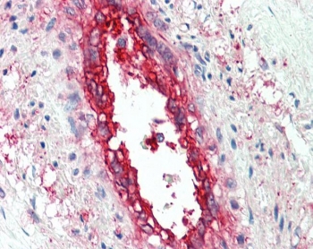 IHC testing of FFPE human vessel with EHD2 antibody at ug/ml. HIER: steamed antigen retrieval with pH6 citrate buffer; A