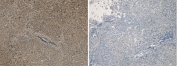 IHC staining of FFPE human liver tissue with (left) and without (right) PCSK9 antibody at 5ug/ml. Required HIER: steamed antigen retrieval with pH6 citrate buffer.