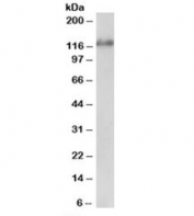 Western blot testing of Jurkat lysate with USP11 antibody at 1ug/ml. Predicted molecular weight: ~110kDa, routinely