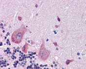 IHC testing of FFPE human cerebellum tissue with DPP10 antibody at 3.75ug/ml. Required HIER: steamed antigen retrieval with pH6 citrate buffer; AP-staining.