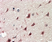 IHC staining of FFPE human cerebral cortex with DCDC2 antibody at 5ug/ml. HIER: steamed with pH6 citrate buffer, AP-staining.