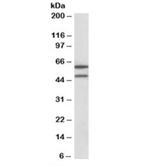 Western blot testing of HeLa lysate with IL13RA2 antibody at 1ug/ml. Predicted molecular weight: ~44/60kDa (unmodified/glycosylated).