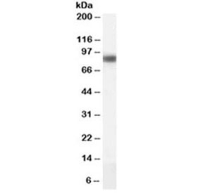 Western blot testing of human liver lysate with CPT1A antibody at 0.1ug/ml. Predicted molecular weight ~86kDa.
