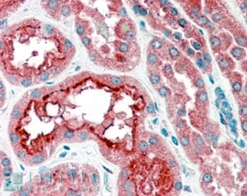 IHC staining of FFPE human kidney with CPT1A antibody at 4ug/ml. HIER: steamed with pH6 citrate buffer, AP-staining.