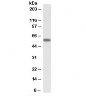 Western blot testing of human skeletal muscle lysate with DIXDC1 antibody at 0.5ug/ml. Predicted molecular weight: ~54kDa.