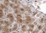 IHC staining of FFPE human liver with CLPP antibody at 2ug/ml. HIER: steamed with pH6 citrate buffer, HRP-staining.