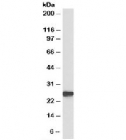 Western blot testing of mouse liver lysate with Peroxiredoxin 6 antibody at 0.1ug/ml. Expected molecular weight: ~25kDa.