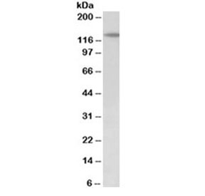 Western blot testing of mouse fetal kidney lysate with PTCH1 antibody at 2ug/ml. Predicted molecular weight ~161/154/144kDa (isoforms L/M/S) with glycosylated PTCH1 visualized at ~200kDa.~