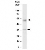 Western blot testing of human placenta lysate with SLC17A5 antibody at 1ug/ml. Predicted molecular weight ~55 kDa and 31 kDa (two isoform) which may be observed at higher molecular weights due to glycosylation.