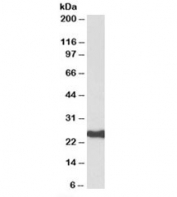 Western blot testing of human amygdala lysate with HDGFRP3 antibody at 0.3ug/ml. Predicted molecular weight: ~23kDa.