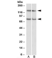 Western blot testing of Jurkat [A] and HeLa [B] lysates with CAPRIN1 antibody at 0.3ug/ml. Predicted molecular weight: ~78kDa but often observed at ~116kDa (phosphorylated CAPRIN1) as well as ~137kDa (GPIP137).
