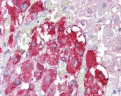 IHC testing of FFPE human adrenal gland tissue with TPTE antibody at 2.5ug/ml. Required HIER: steamed antigen retrieval with pH6 citrate buffer; AP-staining.