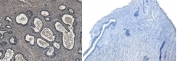 IHC testing of FFPE human prostate tissue with (left) and without (right) ROR1 antibody at 4ug/ml. Required HIER: steamed antigen retrieval with pH6 citrate buffer.