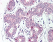 IHC staining of FFPE human breast tissue with FOXA1 antibody at 5ug/ml. HIER: steamed with pH6 citrate buffer, AP-staining.