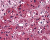 IHC testing of FFPE human adrenal gland tissue with ARIH1 antibody at 5ug/ml. Required HIER: steamed antigen retrieval with pH6 citrate buffer; AP-staining.