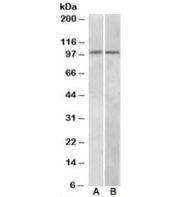 Western blot testing of A549 (A) and Jurkat (B) lysates with HIC1 antibody at 1ug/ml. Predicted molecular weight: ~77kDa but can be observed at ~100kDa.
