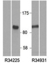 Western blot of HEK293 lysate overexpressing human HIC1 tested with HIC1 antibody at (0.5ug/ml). Mock transfection lanes also shown. Predicted molecular weight: ~77kDa but can be observed at ~100kDa.